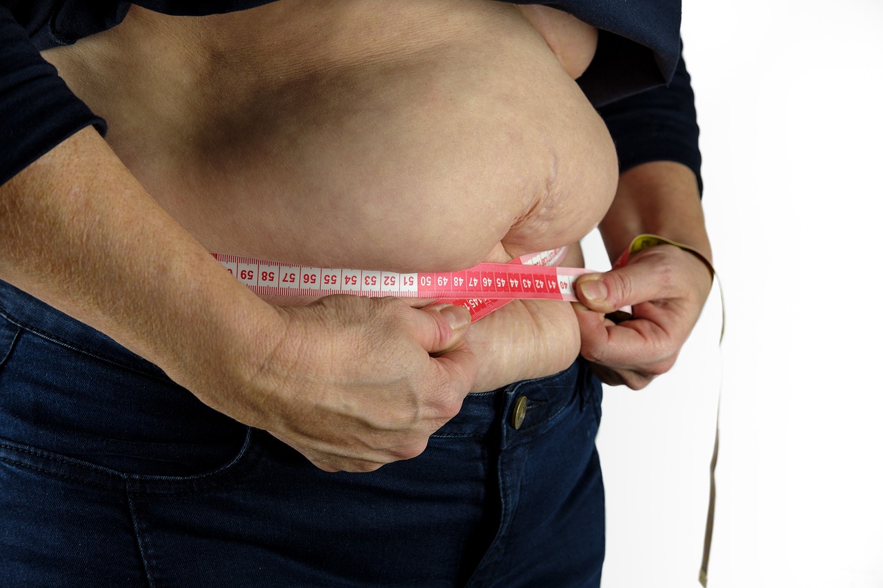La chirurgie bariatrique : Une option sûre pour la perte de poids ?